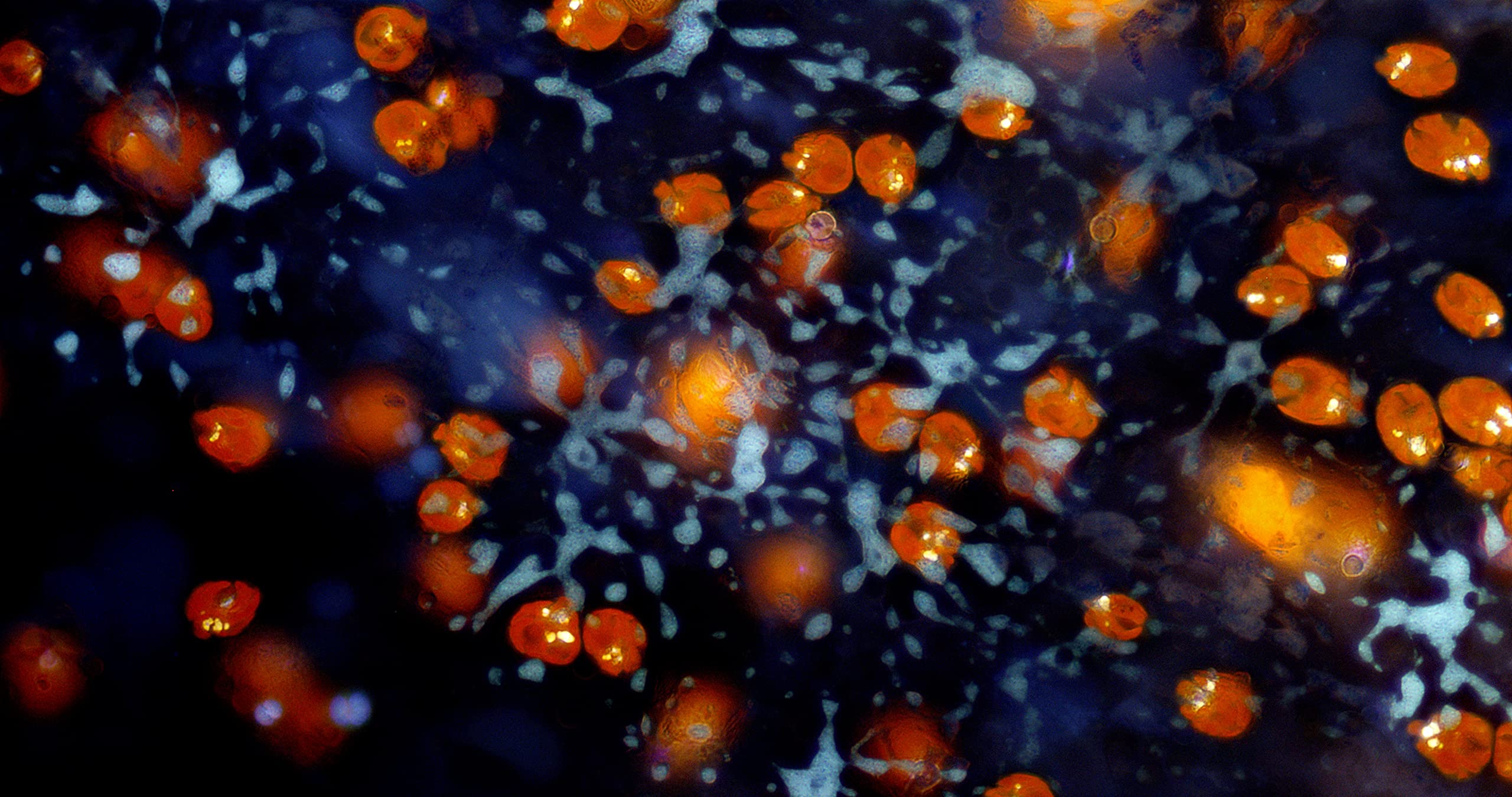 bresser-microcamii-cam-ra-microscope-9mp-4k-sony-imx305 image 3