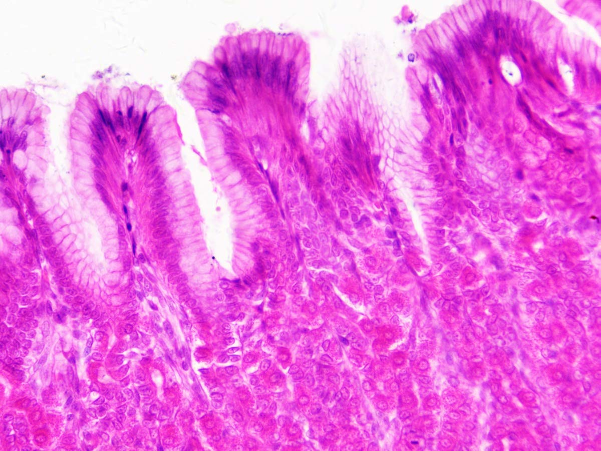 bresser-coffret-bois-30-lames-pr-par-es-microscope-histologie image 6