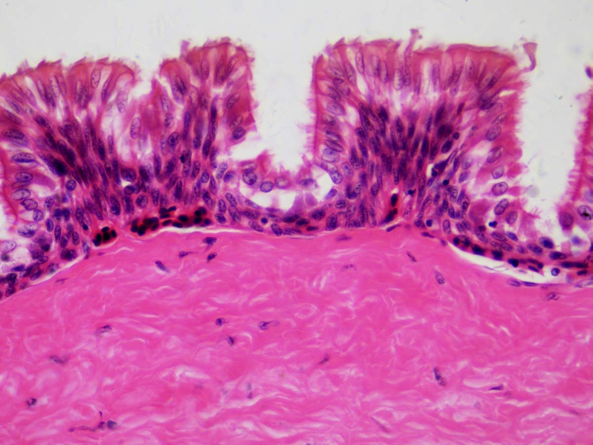 bresser-coffret-bois-30-lames-pr-par-es-microscope-histologie image 4