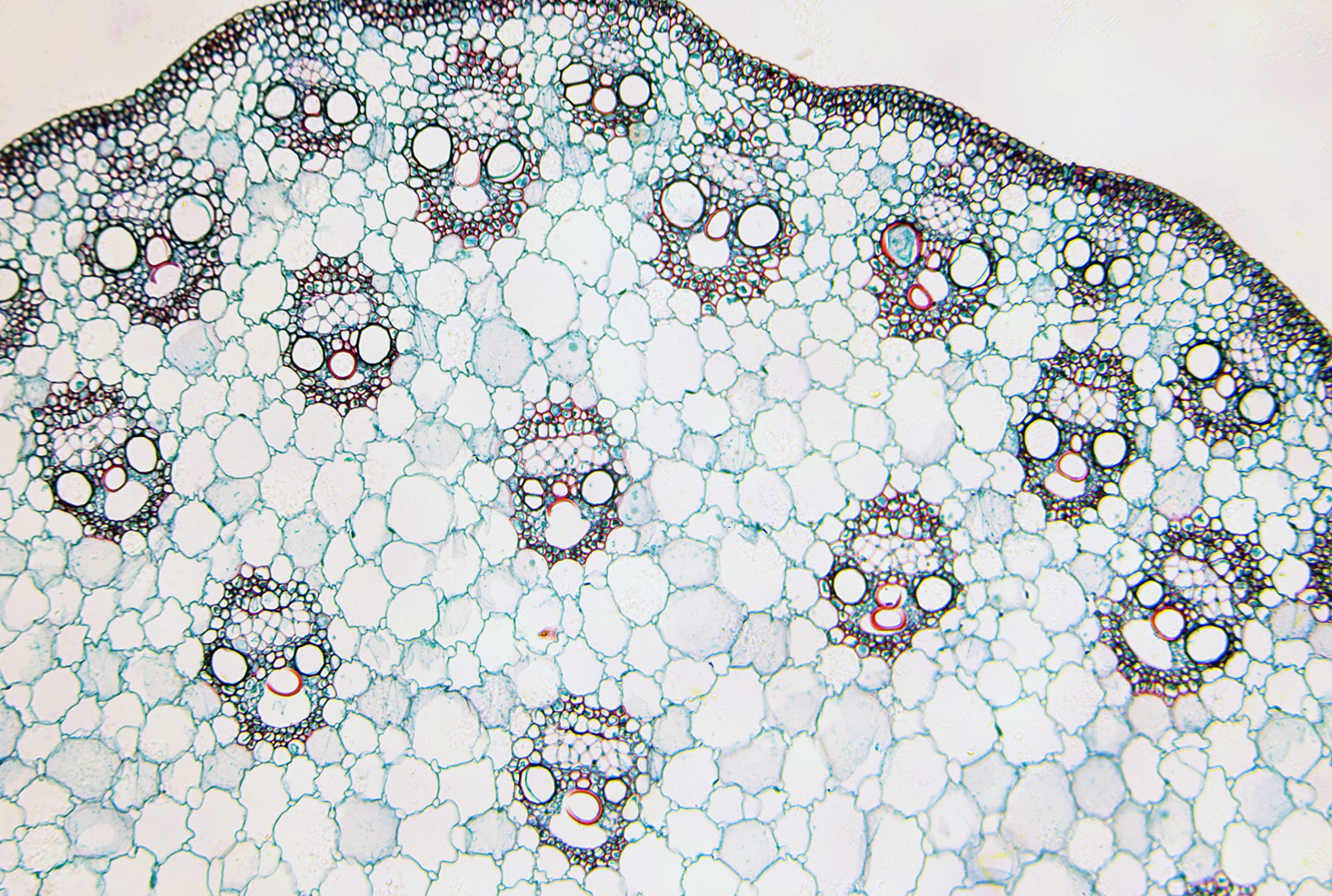 bresser-coffret-lames-pr-par-es-microscope-25-pi-ces-en-bo-te-bois image 2