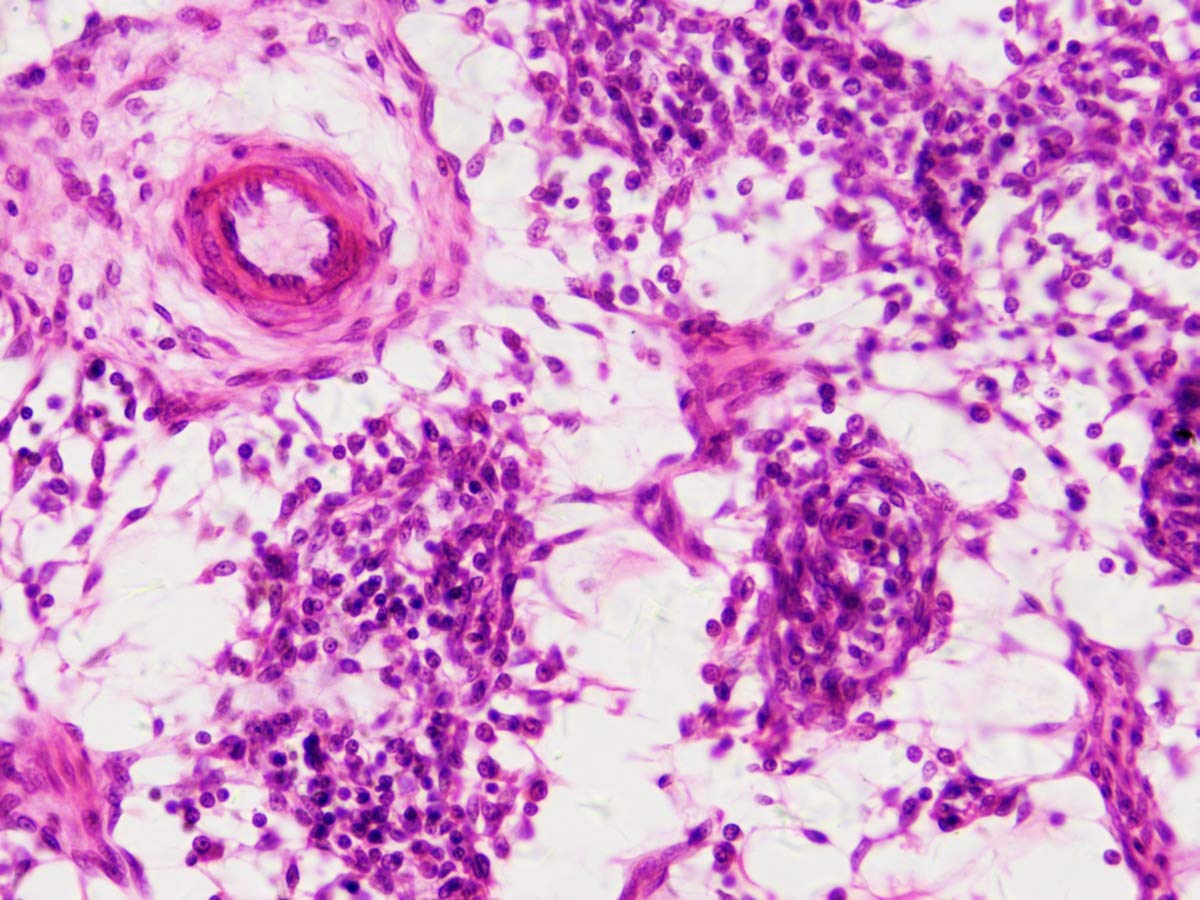 bresser-coffret-bois-30-lames-pr-par-es-microscope-histologie image 5