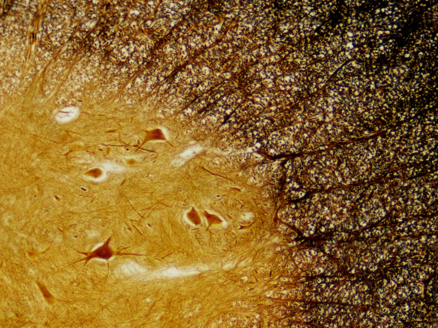 bresser-coffret-bois-30-lames-pr-par-es-microscope-histologie image 3