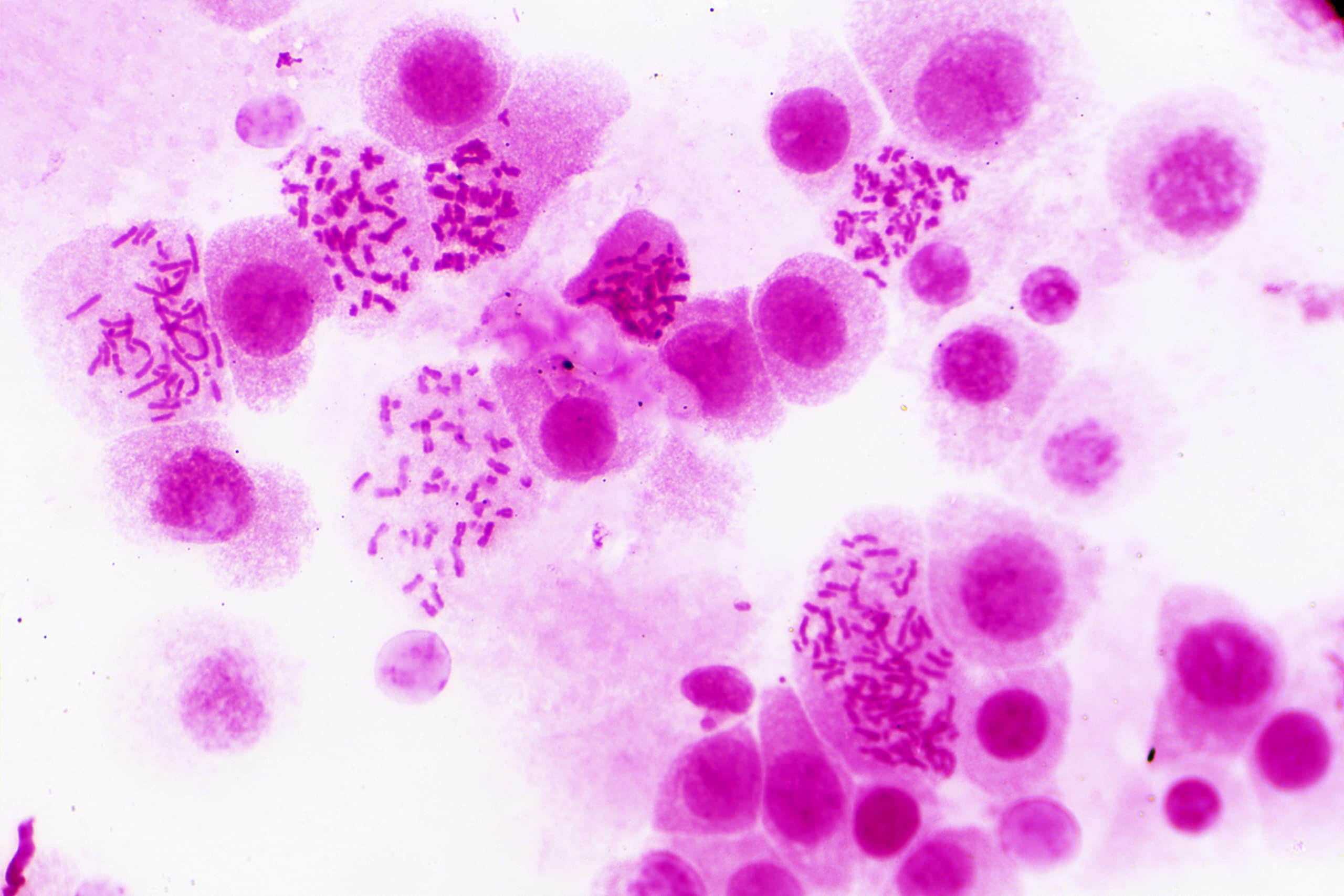bresser-coffret-bois-30-lames-pr-par-es-microscope-histologie image 2