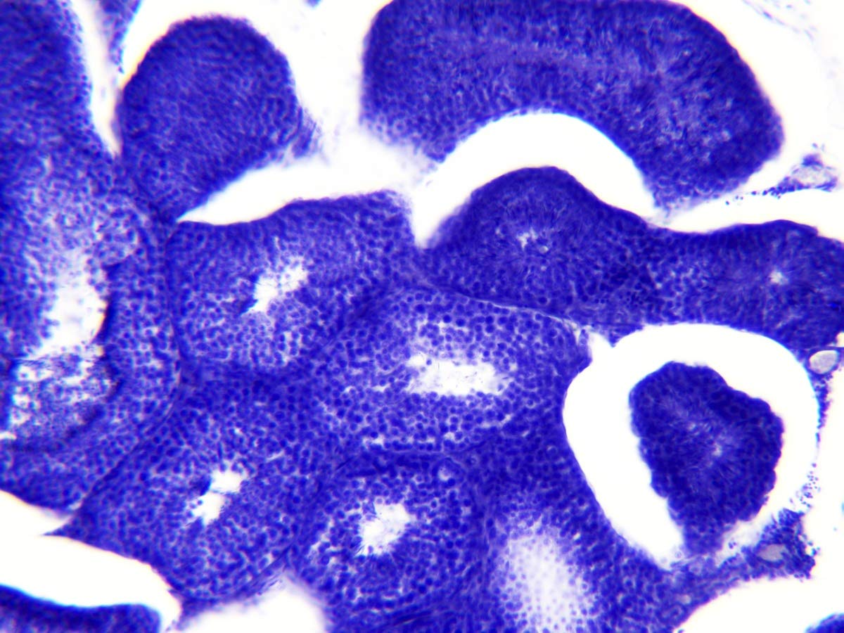 bresser-coffret-bois-30-lames-pr-par-es-microscope-histologie image 8